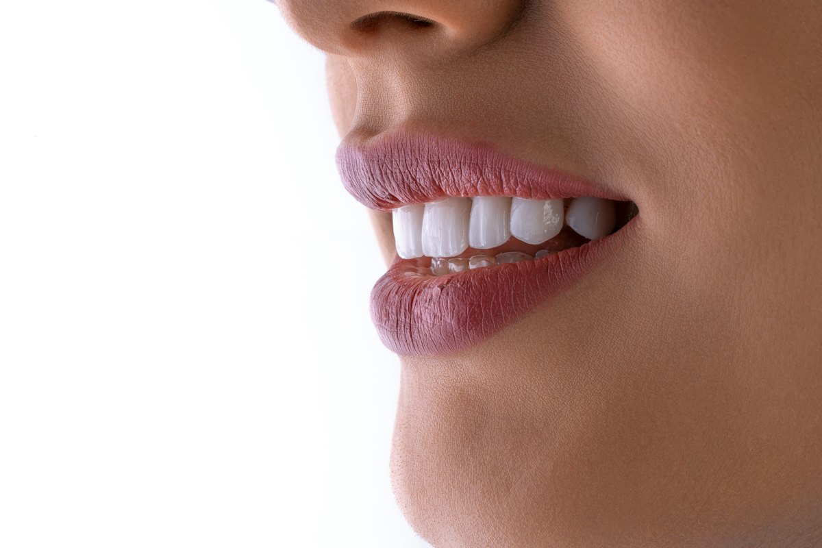 Close de um sorriso com dentes brancos e alinhados